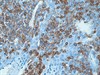 Leukocyte Common Antigen (LCA) Cocktail 0,5 mL