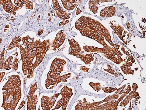 Uroplakin II (Clone: BC21) 1,0 mL