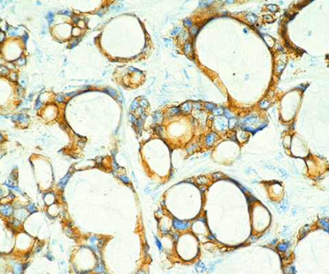 Cytokeratin 20 0,1 mL