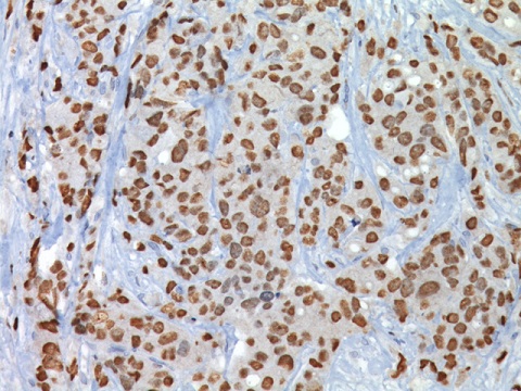 GATA-3 0,1 mL