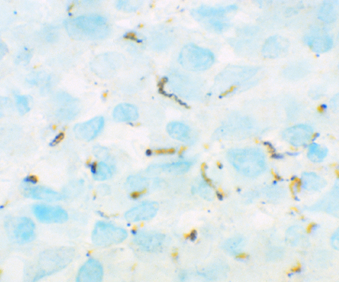 Treponema Pallidum (Spirochete)(POLY) 0,5 mL