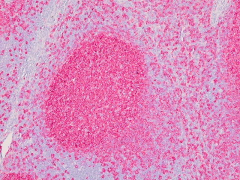 IP Fast Red Chromogen Kit 80 mL