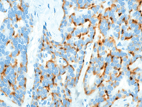 Chromogranin A Cocktail 6 mL