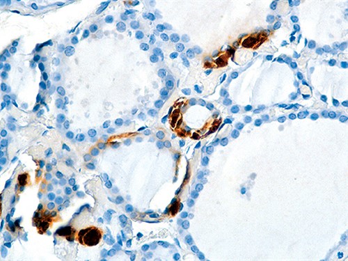 Calcitonin 0,5mL