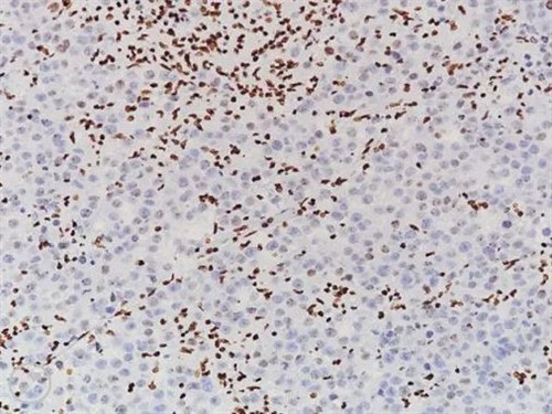 H3K27ME3 [C36B11] 6mL