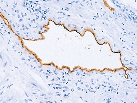 Factor Vlll (Von Willebrand Factor) 0,5 ml