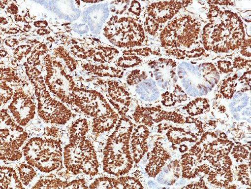 WT1 [rWT1/857] 0.1mL