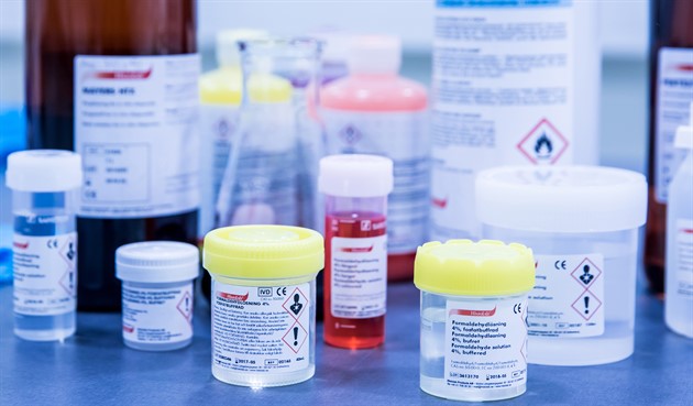 Reagenser &amp; Fixering