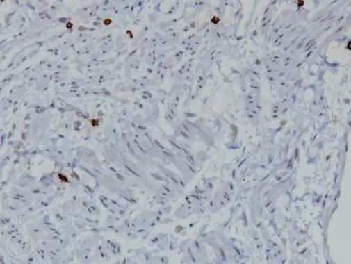 MAST CELL TRYPTASE [AA1] 0.1mL