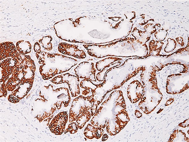 Cytokeratin 5/14 cocktail 1,0 mL