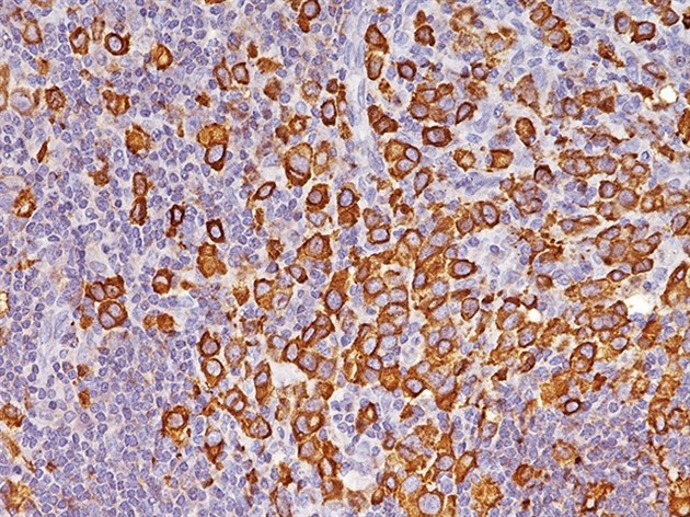 EMA(Epithelial membrane antigen) (E29)  0,1 ml