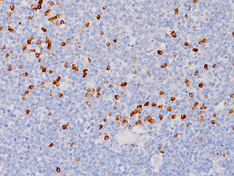 Lambda Light Chain [N10/2] 1,0 ml