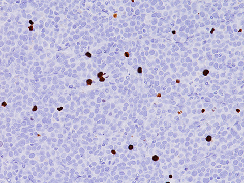 pHH3 (Clone: BC37) 0,1 ml