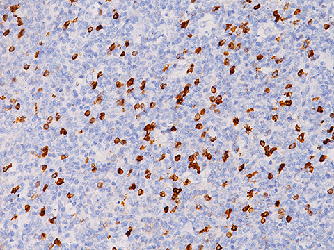 Kappa Light Chain [L1C1] 1,0 mL