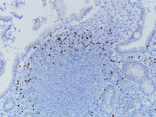 ROR gamma T (clone 6F3.1) 0.5mL