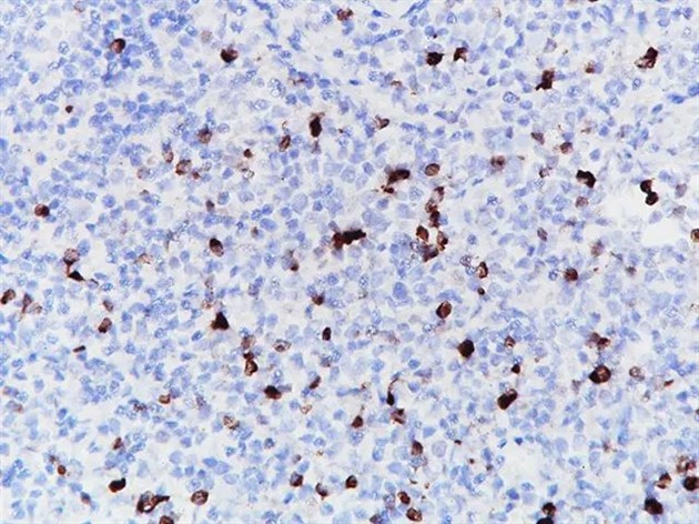 LAG3 [CAL26], 0,1 mL