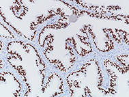 NKX3.1 (D2Y1A) 0.1mL