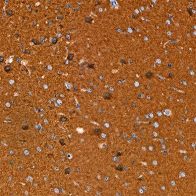 Pan TRK [RM423] 0,1 ml