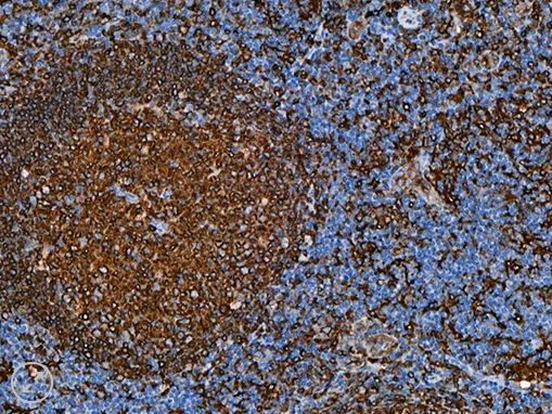 HLA-DR [TAL 185] 1.0 mL