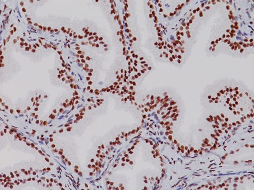 Androgen Receptor 6,0 ml