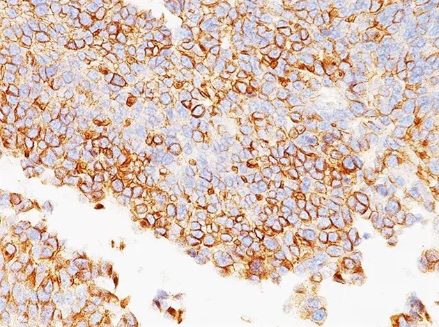 Uroplakin III 6,0 ml