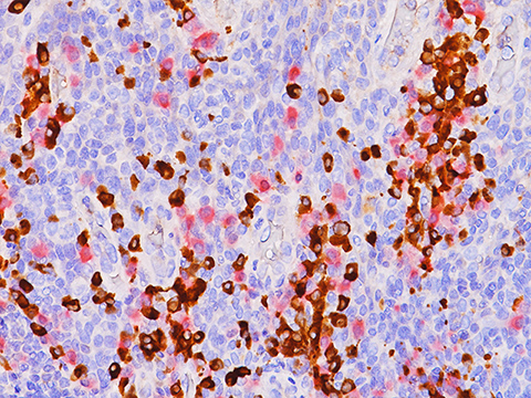 Kappa (M) + Lambda (P) [L1C1 + Polyclonal] 6.0 mL