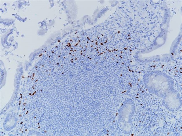 ROR gamma T, (klon: 6F3.1) 6 mL