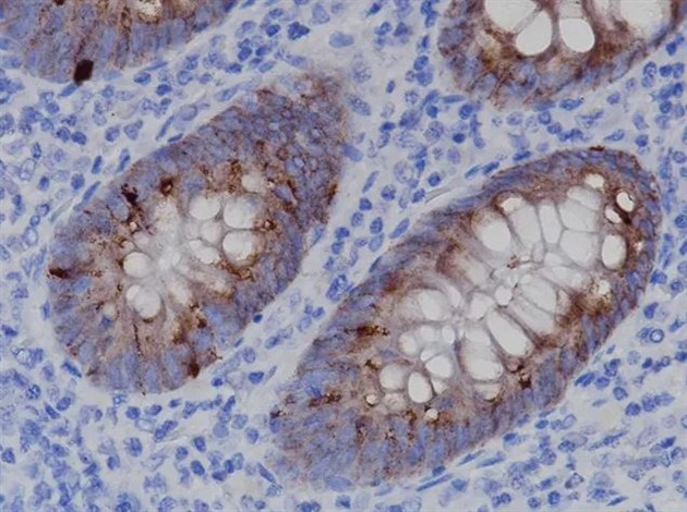 IFNG [IFNG/3996R] 6,0 ml