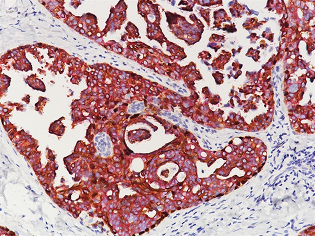 Cocktail (CKHMW/p63+CK7/8/18) 6 ml