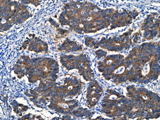 BRAF V600E [VE1] 6 ml