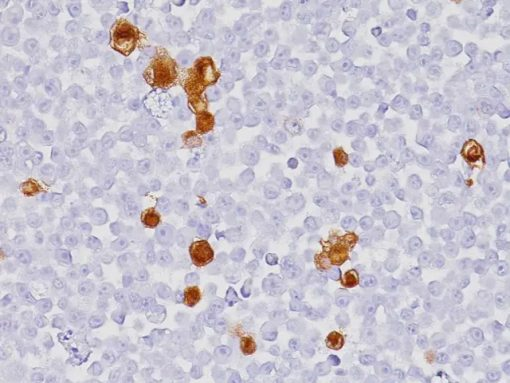 Herpes Simplex 1&2 (HSV1&2) Ultraline 6mL