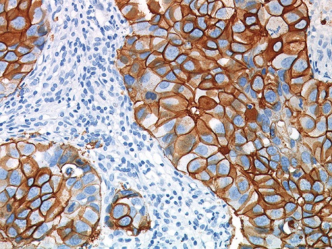 Betazoid DAB Kit 25 mL