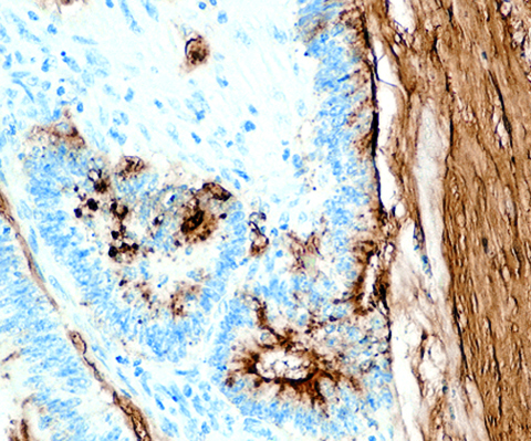 Tumor Associated Glycoprotein (TAG-72)  1,0 mL