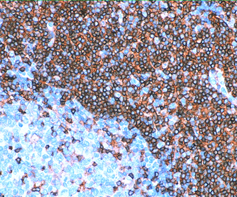 CD43 (T-Cell) (DF-T1) 0,1mL