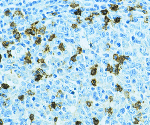 CD57 (Natural Killer Cell) 1,0mL