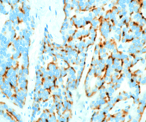 ChromograninA Cocktail 1,0ml