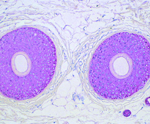 Pan Cytokeratin AE1/AE3 0,1 mL
