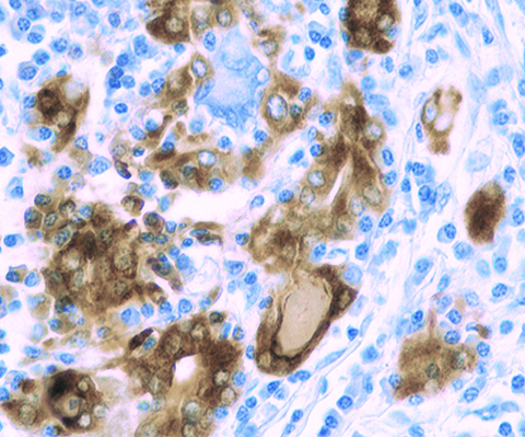 Thyroglobulin (Cocktail) 0,1 mL