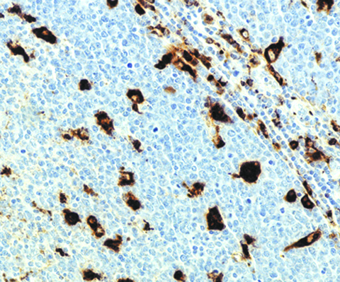 CD68 (Macrophage) (KP1) 0,1mL