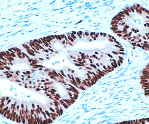 p53 Tumor Suppressor Protein 1,0 mL