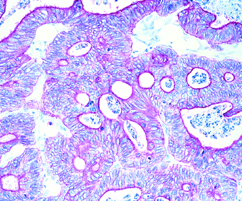 Pan Cytokeratin Lu-5 1,0 mL