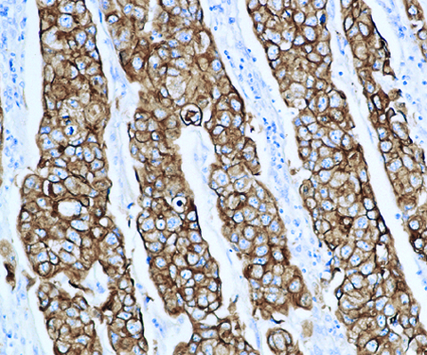Cytokeratin LMW  (8/18)(5D3) 0,1 mL