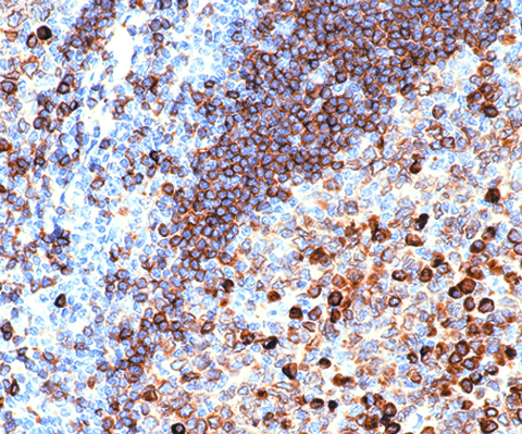 CD79a/mb-1 (B-cell) 0.1ml