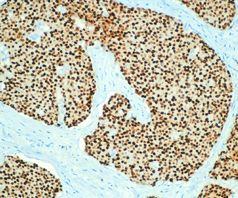 Estrogen Receptor 6F11 1,0 ml