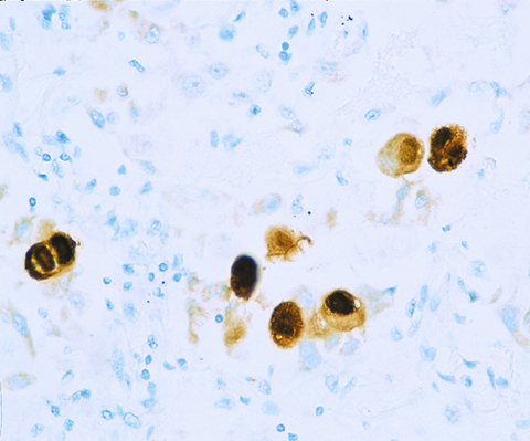 Cytomegalovirus (CMV) 1,0 mL