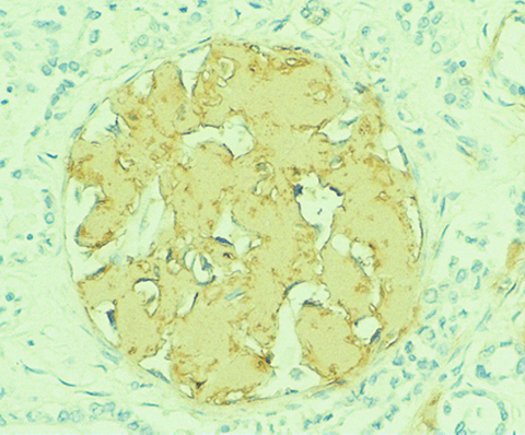 Amyloid A Component 0,1mL