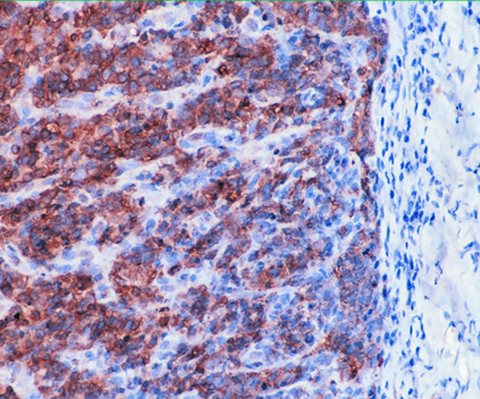 Epithelial Membrane Antigen (EMA) 0,1 mL