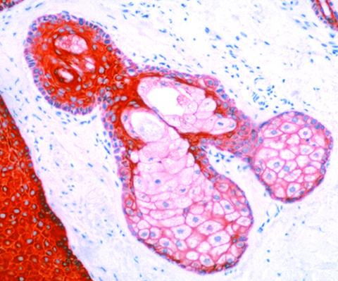 Pan Cytokeratin Plus [AE1/AE3+ 8/18] 1,0 mL