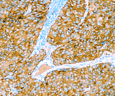 Pan Melanoma Cocktail-3 (HMB45, Tyrosinase and MART-1) 0,5 mL