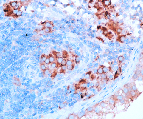 Inhibin, Alpha 0,1 mL